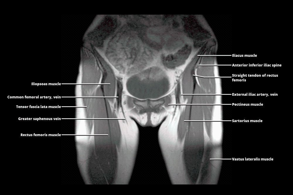 Mri Pelvis